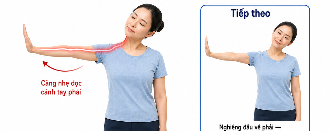 Trượt thần kinh cánh tay Nerve Gliding